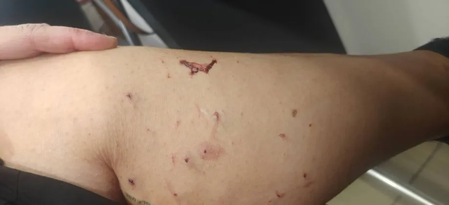Ηράκλειο: Καταγγελία για επίθεση σε γυναίκα – Σε εξέλιξη οι έρευνες για τον σύντροφό της