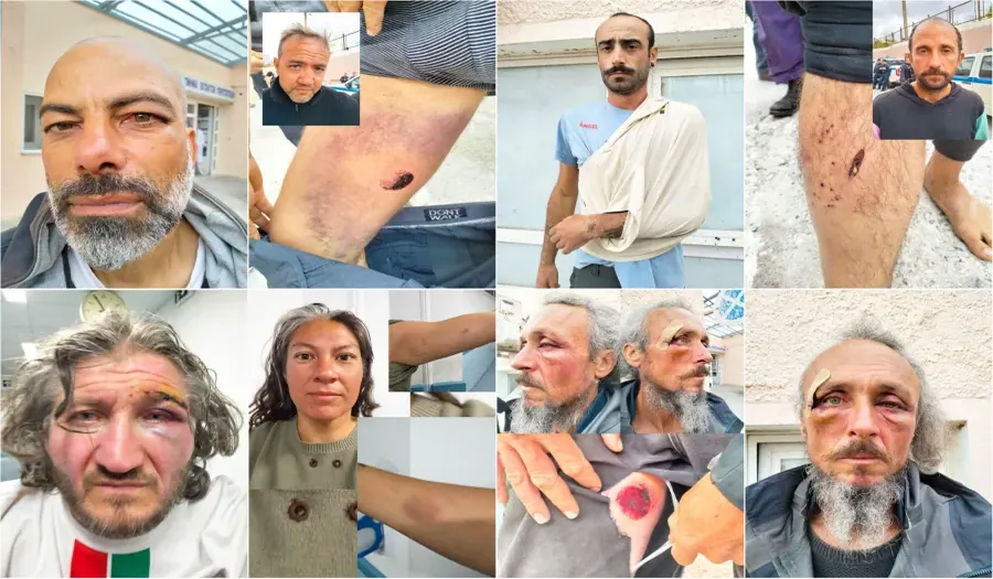 Το Global Sumud Flotilla επιβεβαιώνει αναφορές για βασανιστήρια – Ζητά άμεση διεθνή παρέμβαση καθώς ισραηλινό σκάφος μεταφέρει απαχθέντες αμάχους προς την κατεχόμενη Παλαιστίνη